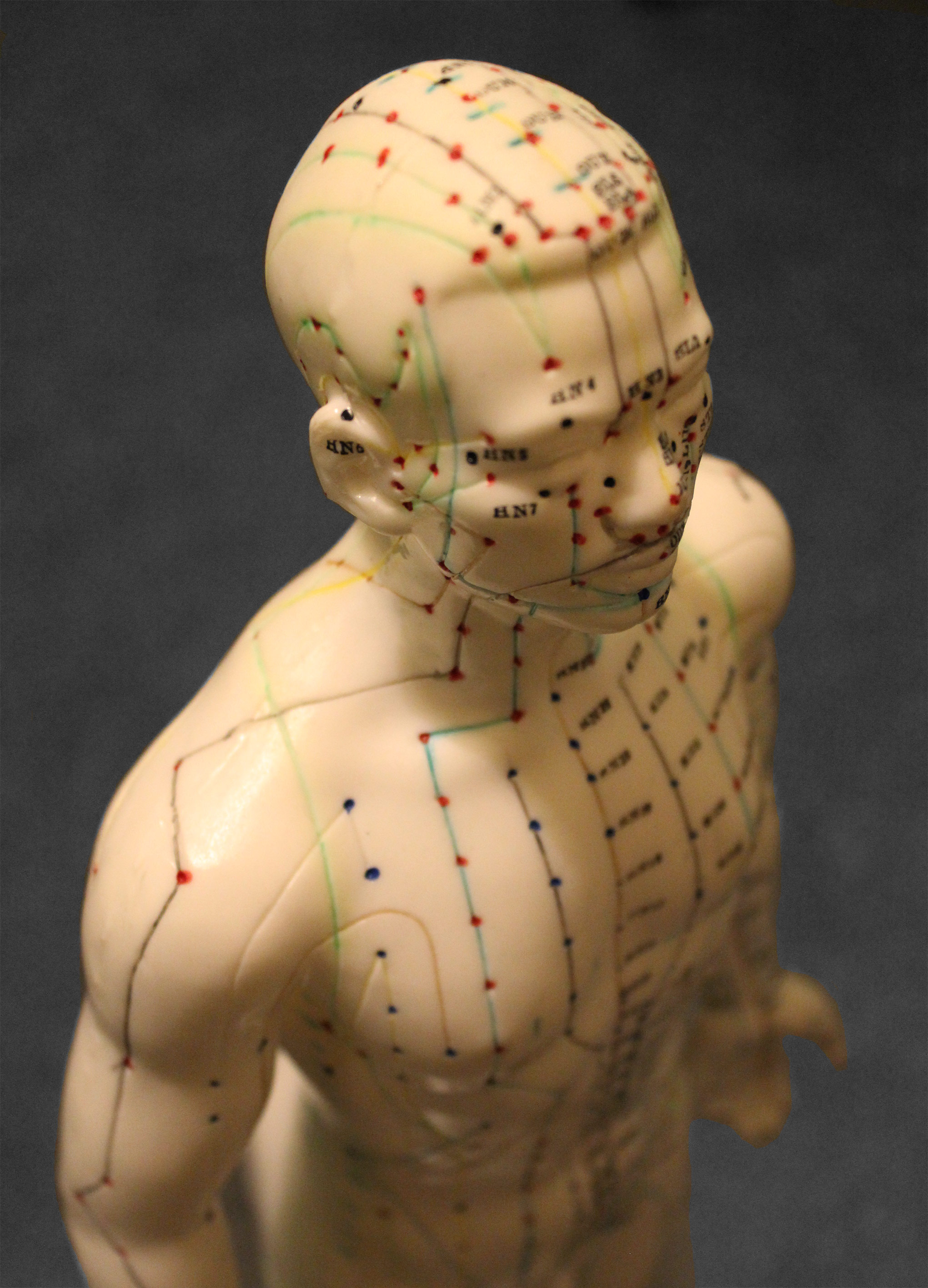 Acupuncture_01