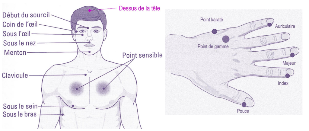 Zones de tapotements pour l'EFT.